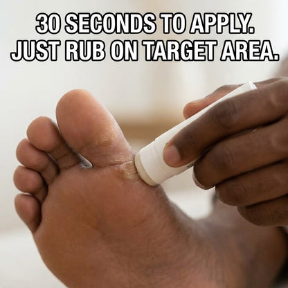 Instant Corn & Callus Remover